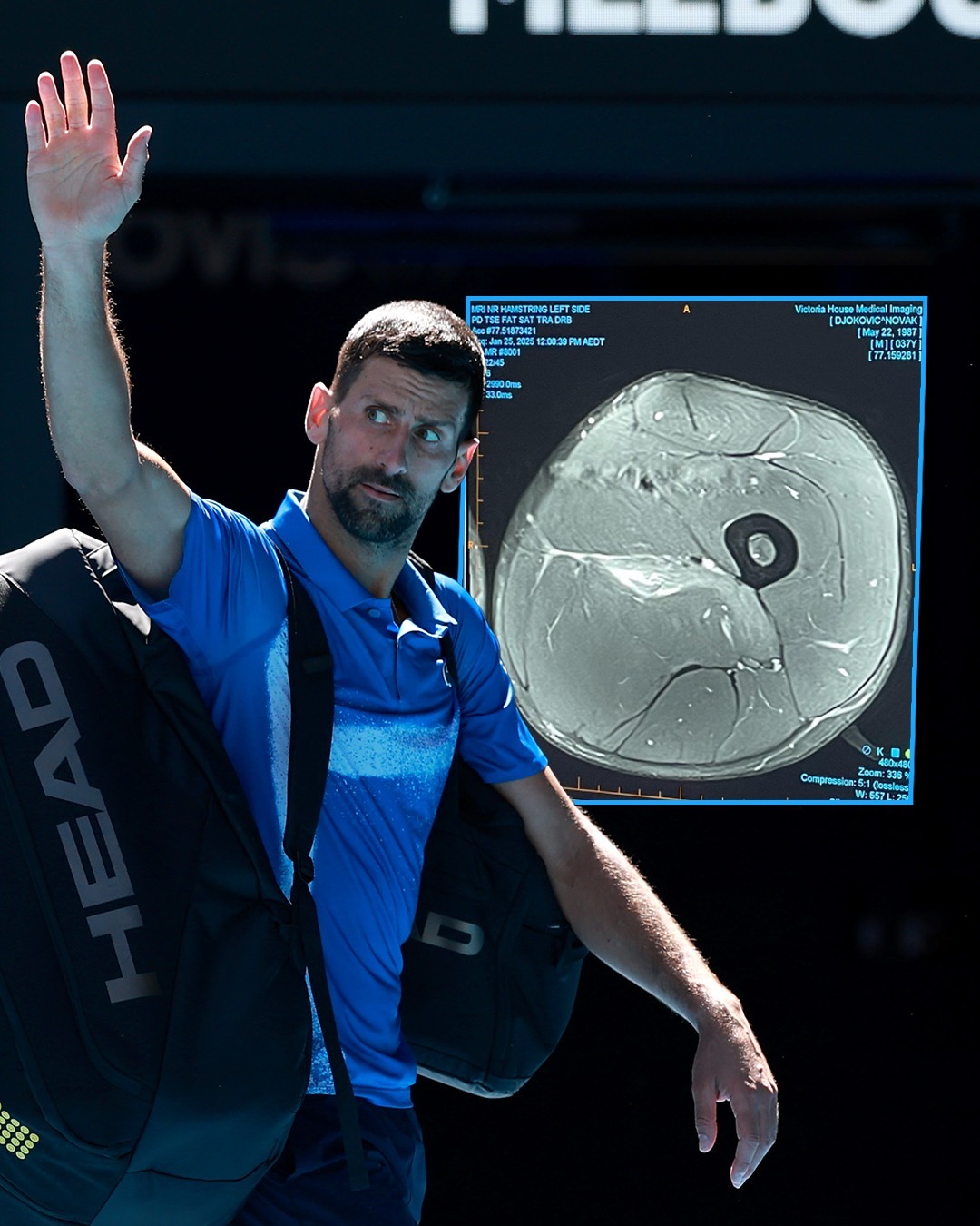 澳网力克拉沃尔杯，德约科维奇状态火热